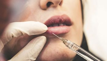 BOTOX - TRATAMIENTOS ARRUGAS EXPRESION FACIAL