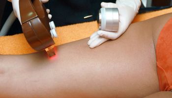 DEPILACION LASER EN GRANADA