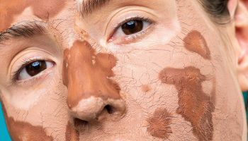 DERMATOLOGIA GRANADA